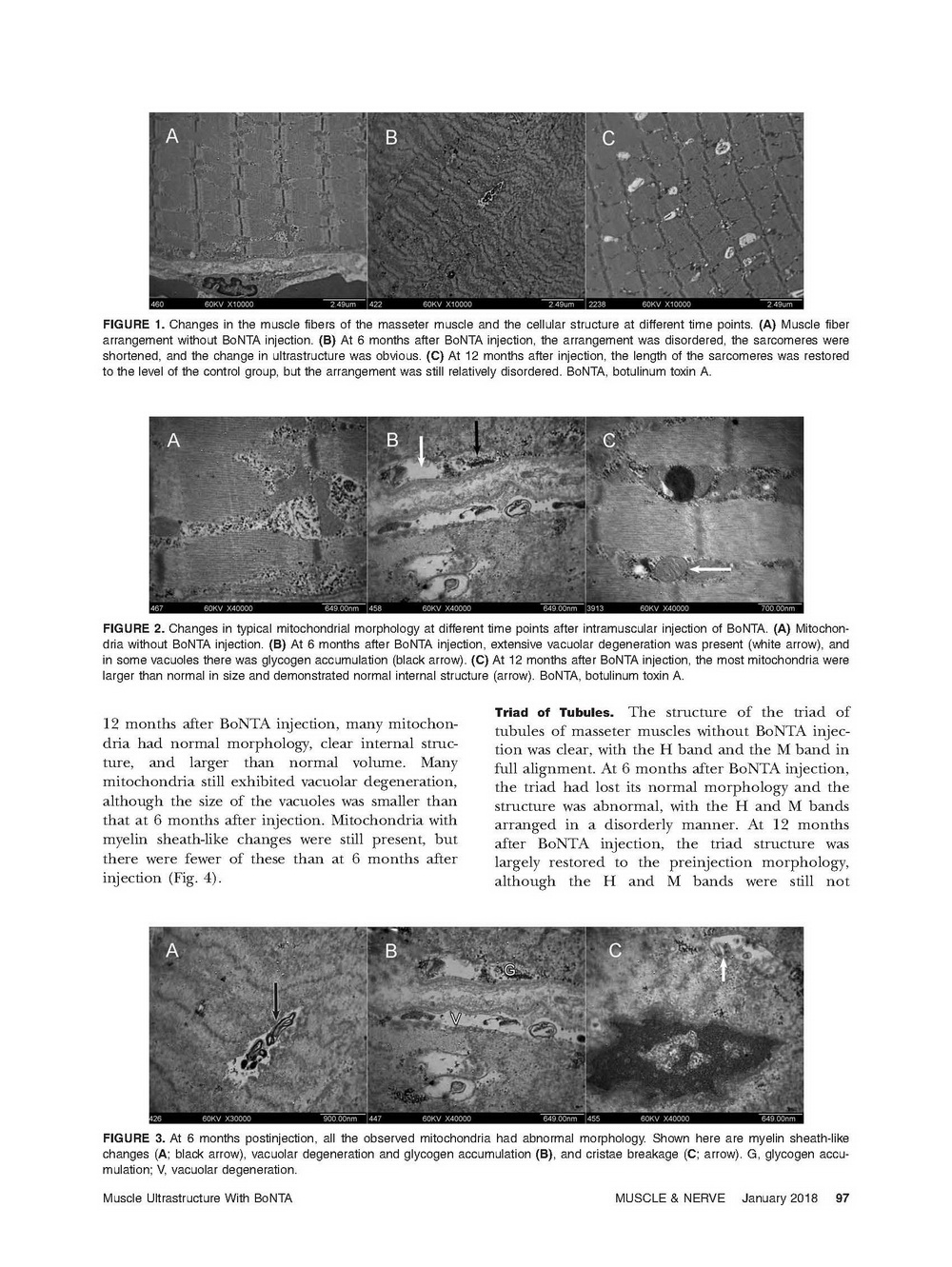 肉毒素文章1